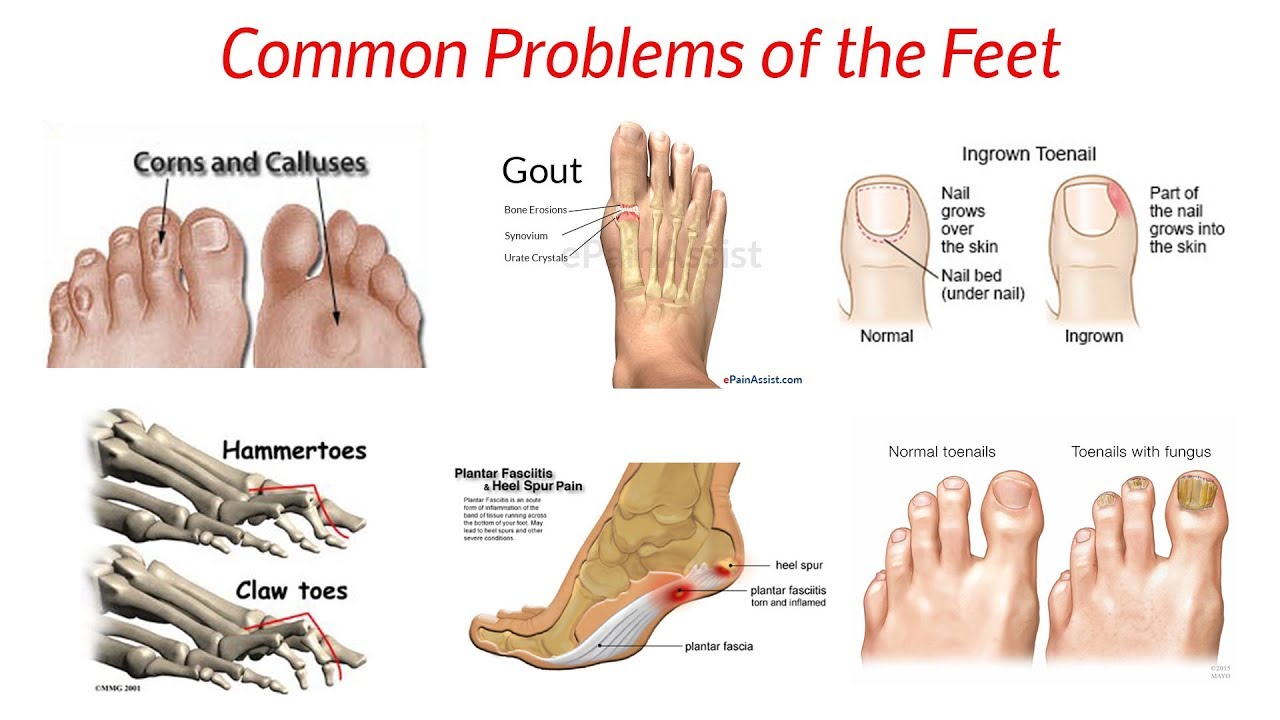 nail problems